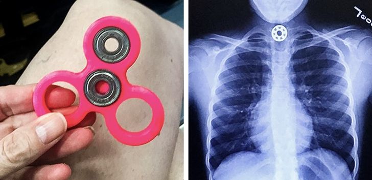 8 món đồ chơi quen thuộc nguy hiểm cho trẻ mà bố mẹ không ngờ đến 8 8 món đồ chơi quen thuộc nguy hiểm cho trẻ mà bố mẹ không ngờ đến 8