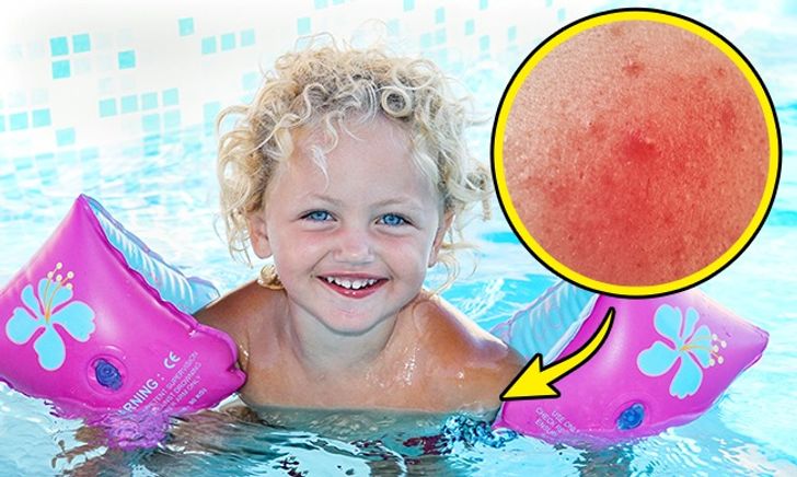 8 món đồ chơi quen thuộc nguy hiểm cho trẻ mà bố mẹ không ngờ đến 3 8 món đồ chơi quen thuộc nguy hiểm cho trẻ mà bố mẹ không ngờ đến 3