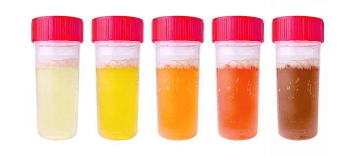 10 dấu hiệu bạn cần đi khám ngay bởi thận đang 'lâm nguy' 10 10 dấu hiệu bạn cần đi khám ngay bởi thận đang 'lâm nguy' 10
