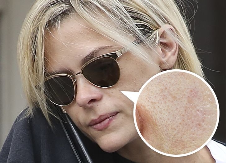 Những thói quen khiến 7749 bước skincare của bạn đều 'đổ sông đổ biển' 2 Những thói quen khiến 7749 bước skincare của bạn đều 'đổ sông đổ biển' 2