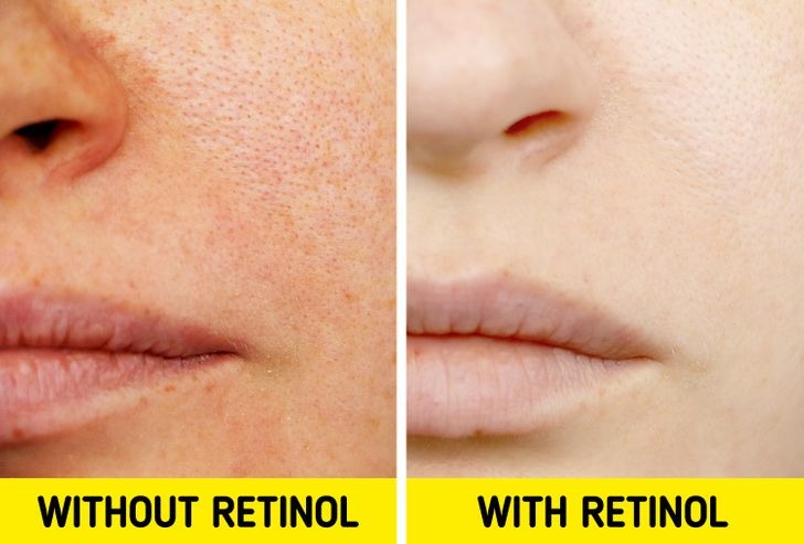 Những thói quen khiến 7749 bước skincare của bạn đều 'đổ sông đổ biển' 1 Những thói quen khiến 7749 bước skincare của bạn đều 'đổ sông đổ biển' 1