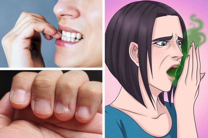 Cắn móng tay: Thói quen gây combo hậu quả xấu xí, hôi hám, bệnh tật 2 Cắn móng tay: Thói quen gây combo hậu quả xấu xí, hôi hám, bệnh tật 2