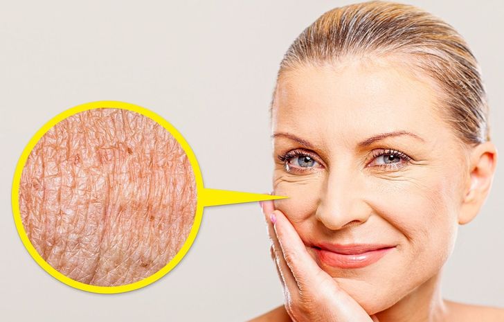 Môi mỏng, bọng mắt và loạt dấu hiệu cảnh báo mặt bạn đang lão hóa sớm 3 Môi mỏng, bọng mắt và loạt dấu hiệu cảnh báo mặt bạn đang lão hóa sớm 3