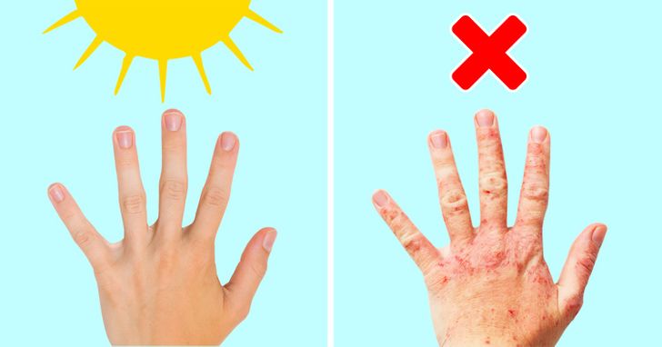 7 tác hại khôn lường khi thiếu 'vitamin ánh nắng' 5 7 tác hại khôn lường khi thiếu 'vitamin ánh nắng' 5