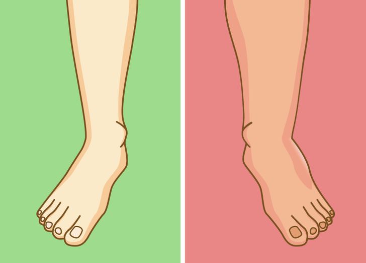 5 tác hại khiến bạn bỏ ngay thói quen ngồi vắt chéo chân 5 5 tác hại khiến bạn bỏ ngay thói quen ngồi vắt chéo chân 5