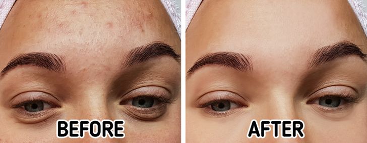 7 món ăn vào khiến cơ thể vừa sạch, vừa thơm, cả năm không dùng đến thuốc 3 7 món ăn vào khiến cơ thể vừa sạch, vừa thơm, cả năm không dùng đến thuốc 3