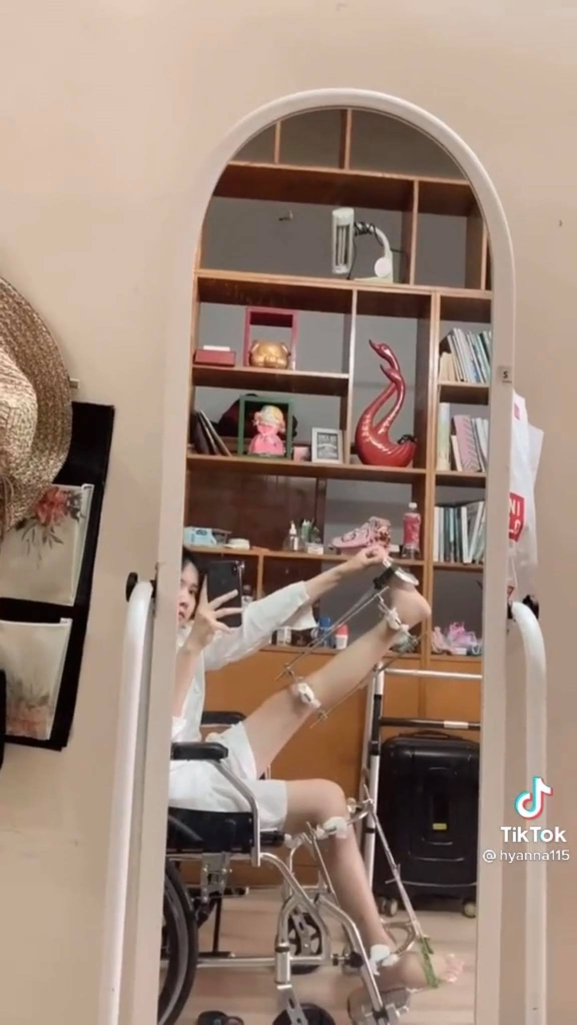 Cô nàng 'nấm lùn' review quá trình kéo dài chân khiến dân tình chỉ biết chốt hạ 'thêm tiền cũng không dám' 5 Cô nàng 'nấm lùn' review quá trình kéo dài chân khiến dân tình chỉ biết chốt hạ 'thêm tiền cũng không dám' 5