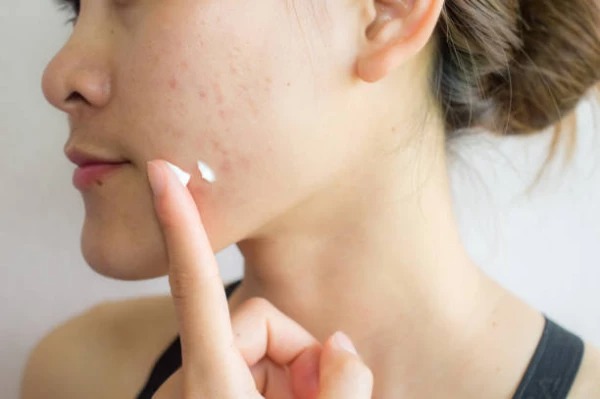 10 bước skincare chuẩn Hàn và 3 bước chăm gia cơ bản: Đâu mới là chân ái? 2 10 bước skincare chuẩn Hàn và 3 bước chăm gia cơ bản: Đâu mới là chân ái? 2
